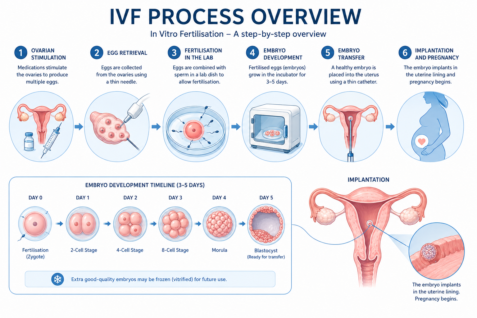 What Is IVF Treatment?