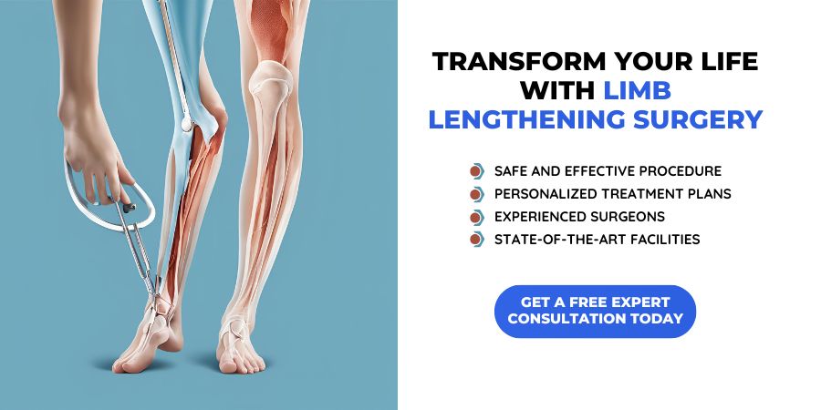 Limb Lengthening Surgery